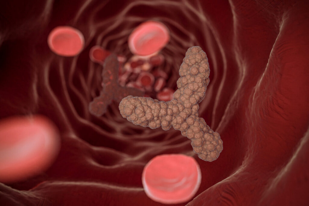 Penki mitybos įpročiai, kurie gali padėti paprastai mažinti cholesterolį