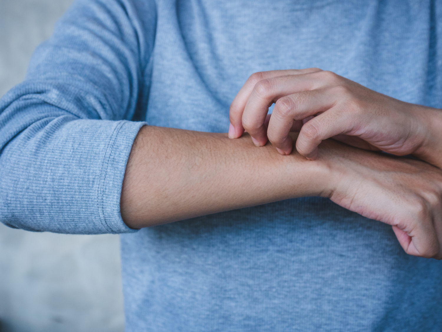 Greitas būdas numalšinti uodo įkandimą vos per 20 sekundžių